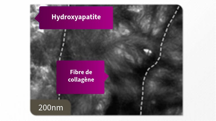 Cliché MET de la dentine à 200 nm