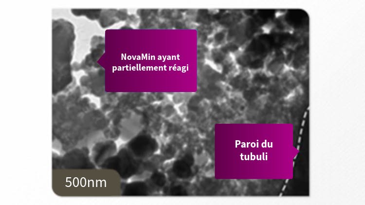 Cliché MET de la dentine à 500 nm