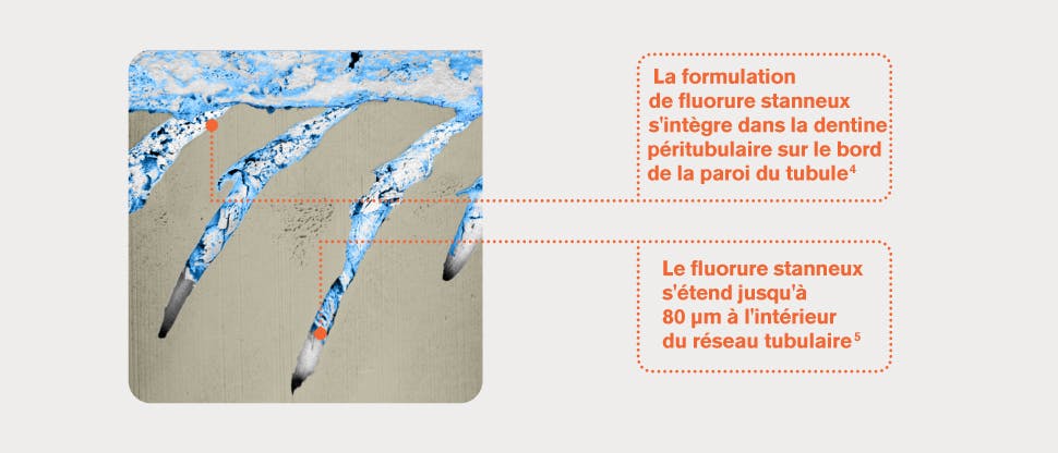 Image SIF-MEB représentatif de tubules dentinaires