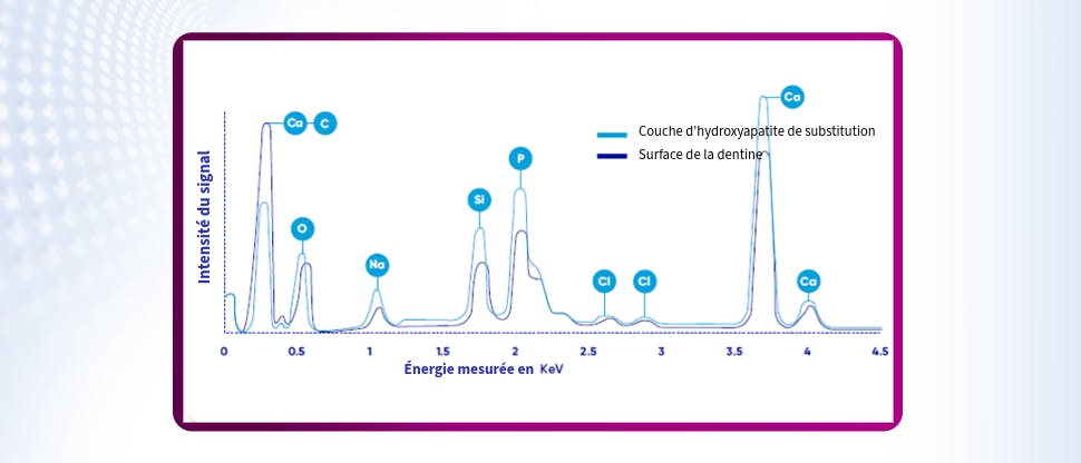 Tracés radiographiques du graphique de la dentine