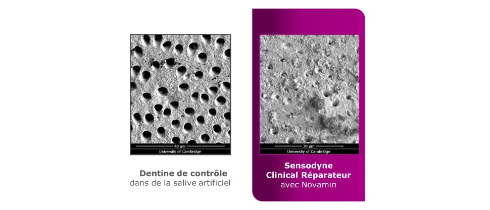 Image de tubuli dentinaires après l’utilisation du dentifrice