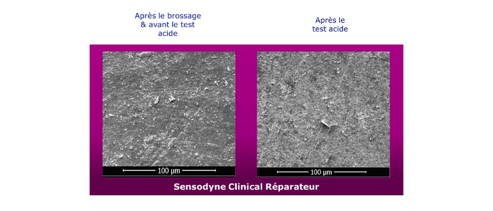 Images de la dentine après  l’utilisation de Sensodyne Professional Réparation et après le test acide pour montrer la résistance.