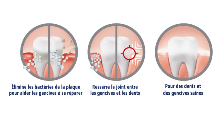 Illustration montrant la manière dont parodontax  Réparation Active Gencives enlève les bactéries de la  plaque, resserre le joint entre les gencives et les dents  et aide à avoir des dents et des gencives saines