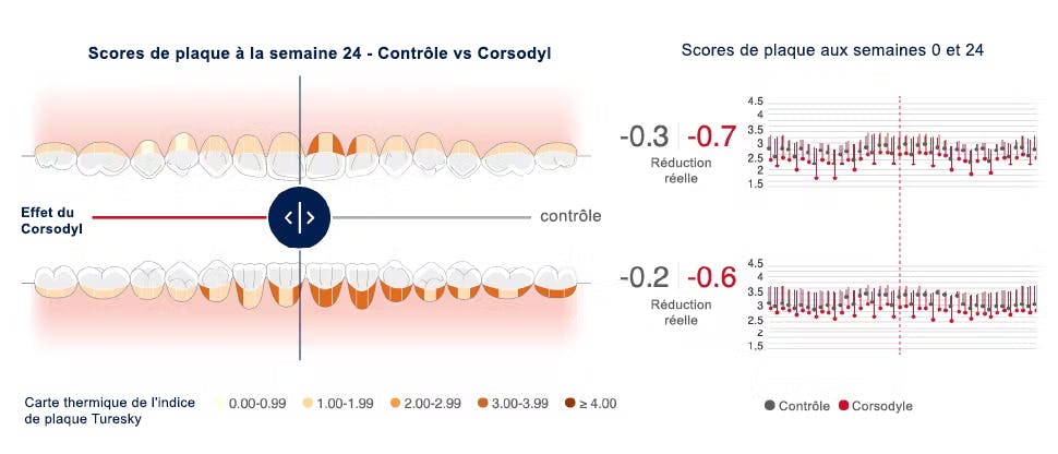 Image de l'outil de cartographie buccale montrant la réduction de la plaque dentaire après l'utilisation du dentifrice au bicarbonate de sodium Paradontax