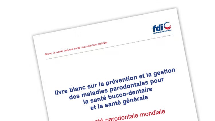 Livre blanc de la FDI sur la prévention et la gestion des maladies parodontales pour la santé bucco-dentaire et la santé générale