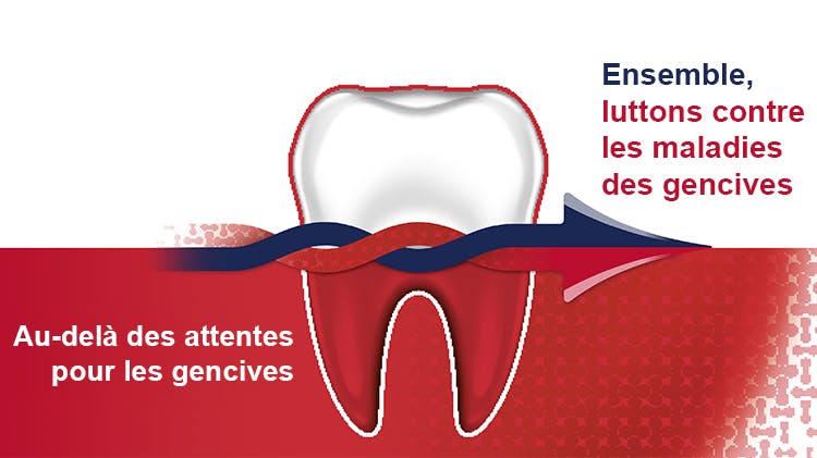 Le dentifrice au fluor Parodontax aide à prévenir et à traiter les saignements des gencives et à lutter contre la gingivite.