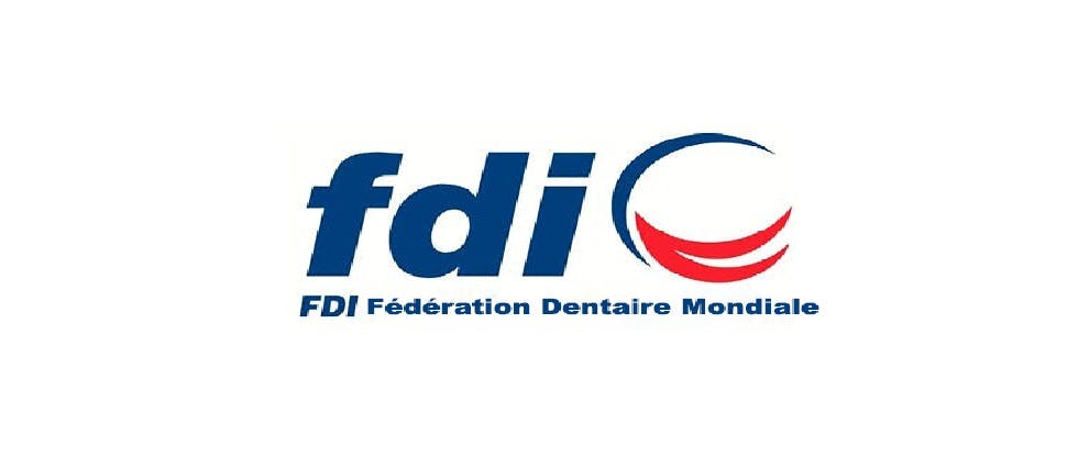 FDI