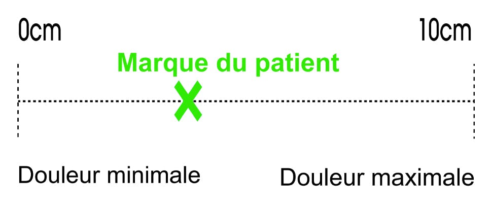 Échelle visuelle analogique - outil de suivi de la douleur