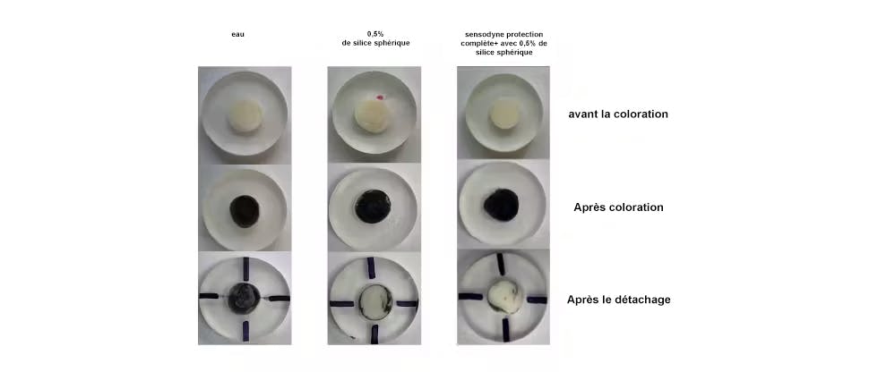 Image de la coloration des dents après le brossage