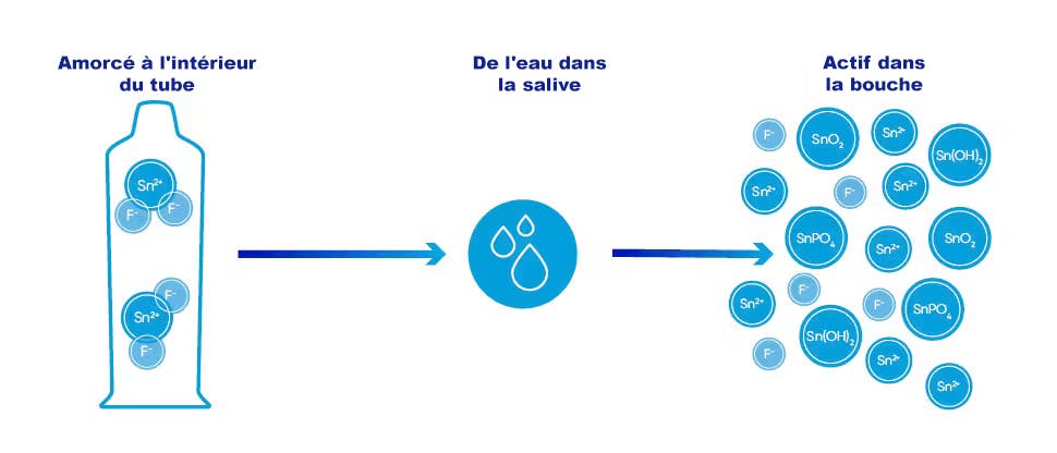 Exemple de l'action du fluorure stanneux dans la cavité buccale/la bouche