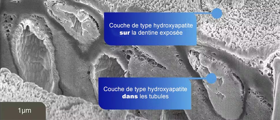 Image SEM de la couche d'hydroxyapatite sur la dentine exposée