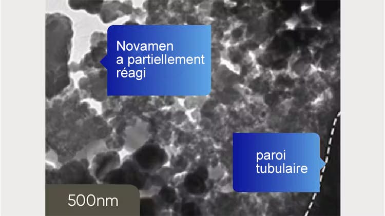 Image TEM de la dentine à 500 nm