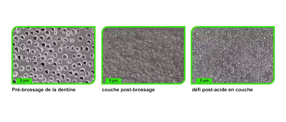 Images de la surface de la dentine obtenues au microscope électronique à balayage (MEB)