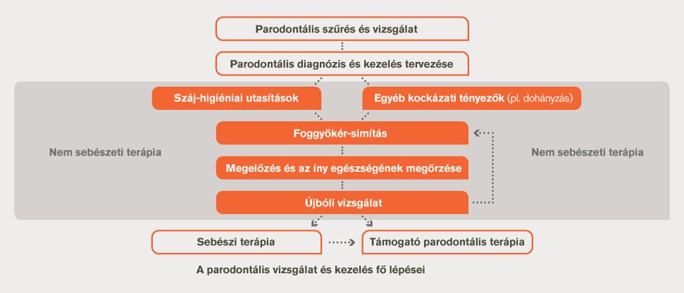 A fogágybetegség vizsgálatának és kezelésének folyamatábrája