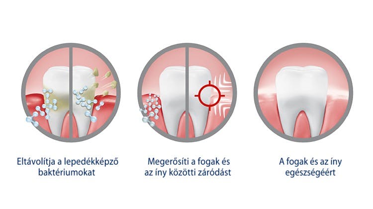 Ábra arról, hogy a Parodontax Active Gum Repair eltávolítja a lepedékbaktériumokat, meghúzza az ínytömítést, és segít egészségben tartani a fogakat és az ínyt