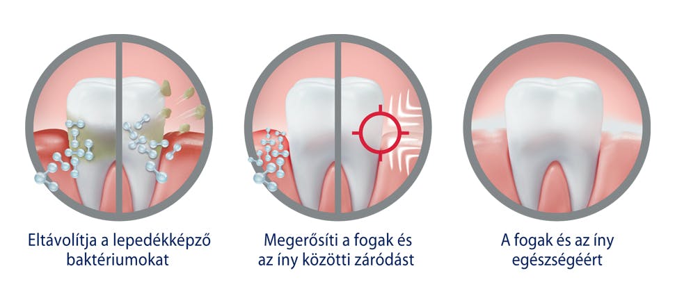 Ábra arról, hogy a Parodontax Active Gum Repair eltávolítja a lepedékbaktériumokat, meghúzza az ínytömítést, és segít egészségben tartani a fogakat és az ínyt