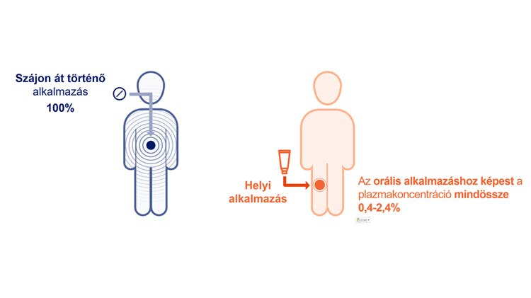 A topikális vény nélkül kapható Voltaren termékek alkalmazása