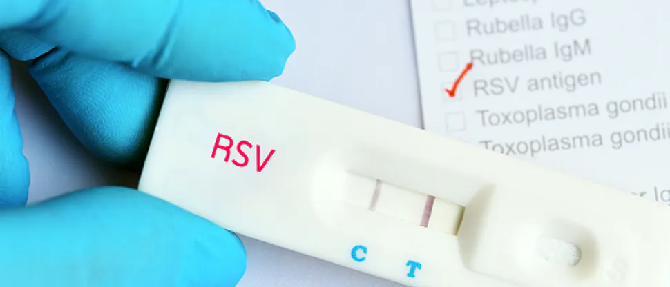 RSV (Respiratory syncytial virus) -antigént kimutató gyorsteszt képe pozitív teszteredménnyel