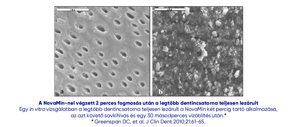 Novaminnel végzett fogmosás után