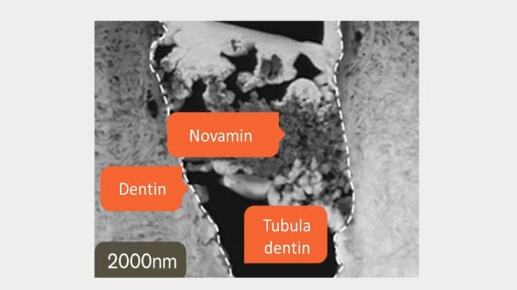 Gambaran TEM dari Dentin pada 2000nm