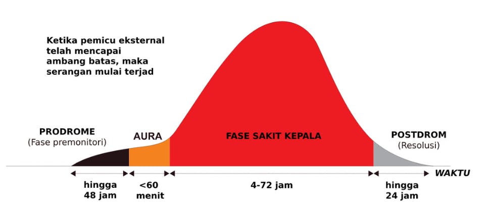 Empat fase migrain