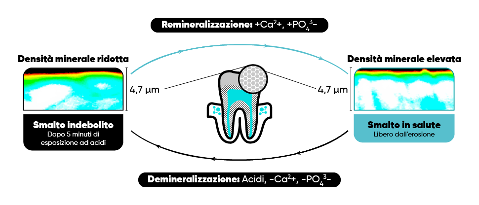 Erosione del dente - infografica sul ciclo di demineralizzazione e remineralizzazione