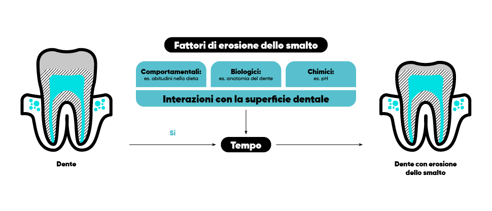 Infografica sui fattori coinvolti nell’erosione dello smalto