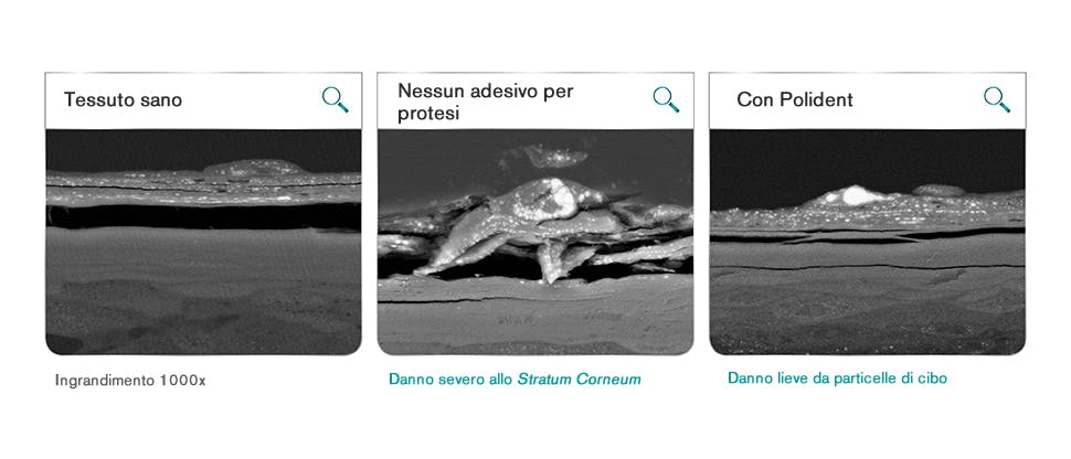 Tessuto orale dopo 12 ore di agitazione con semi di papavero e dischetti acrilici, in test di laboratorio