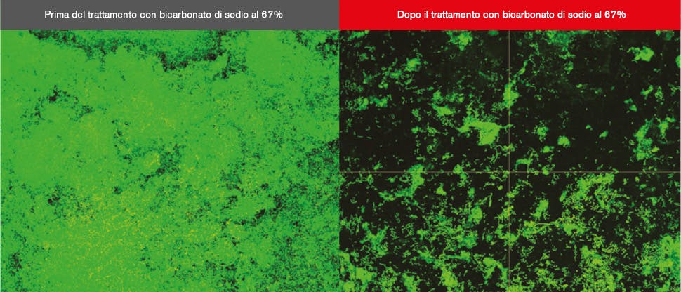 Immagini del biofilm al microscopio confocale a scansione laser (CLSM)