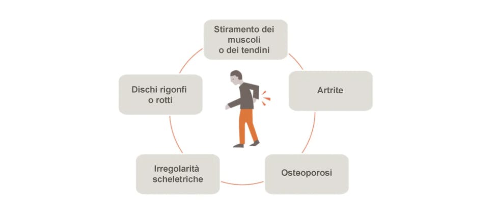 Grafico che illustra le potenziali cause del mal di schiena