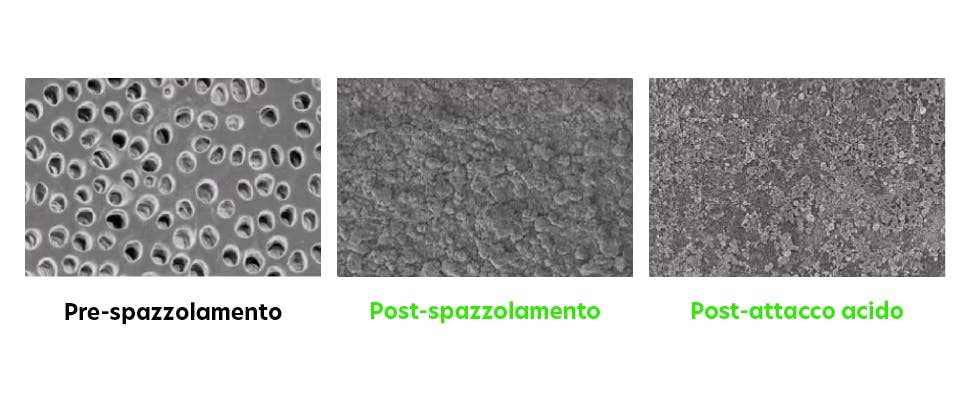 Immagini della superficie dentinale ottenute con il microscopio elettronico a scansione (SEM) 