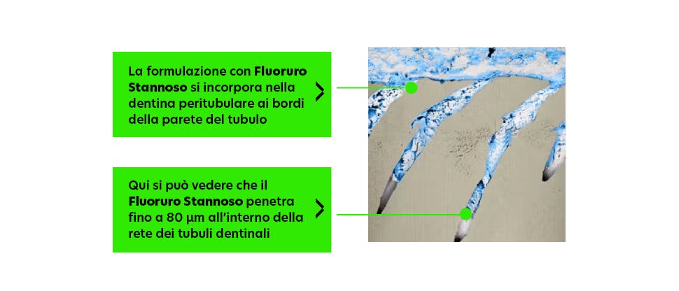 Immagine rappresentativa FIB-SEM dei tubuli dentinali