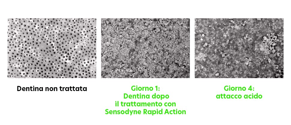 Immagini SEM della dentina