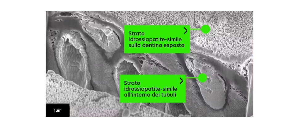 SEM image of hydroxyapatite-like layer