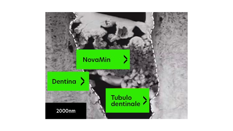 Immagine TEM della dentina a 2000 nm