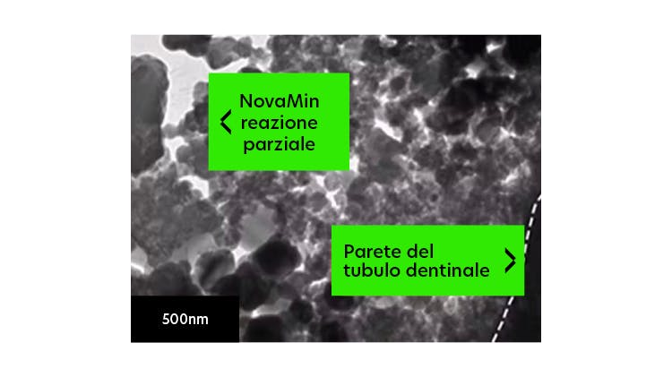 Immagine TEM della dentina a 500 nm