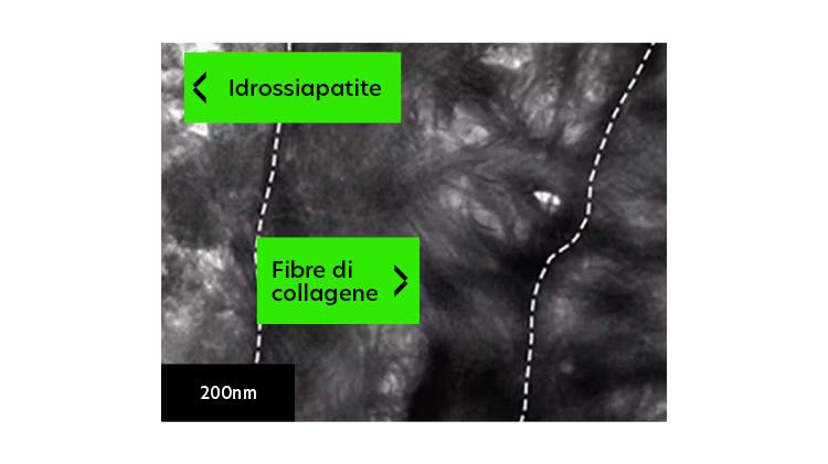 Immagine TEM della dentina a 200 nm