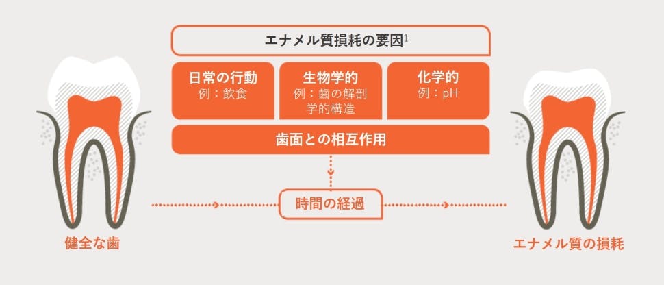 エナメル質損耗の要因