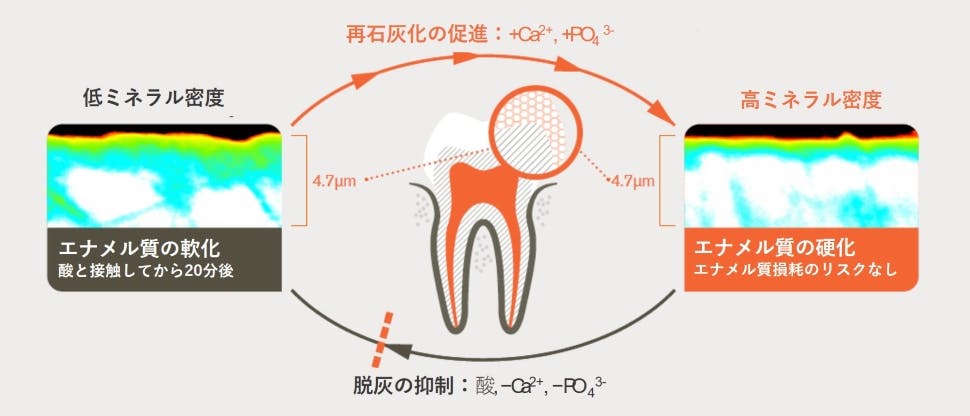 エナメル質を二重に保護