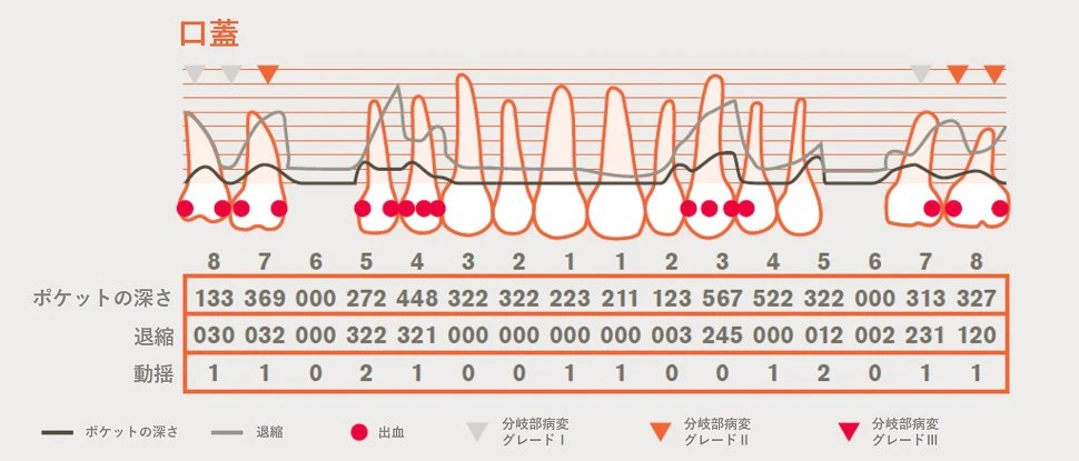 歯科用カルテの利点