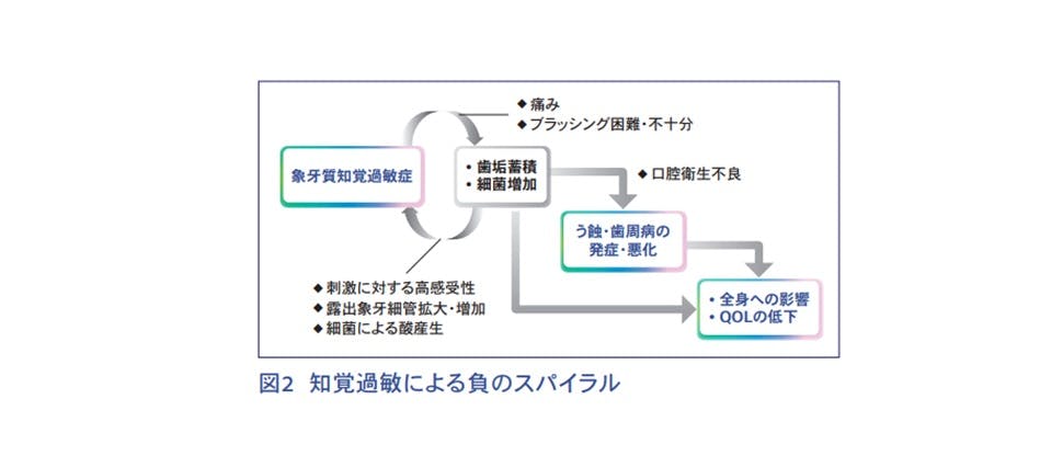 知覚過敏による負のスパイラル