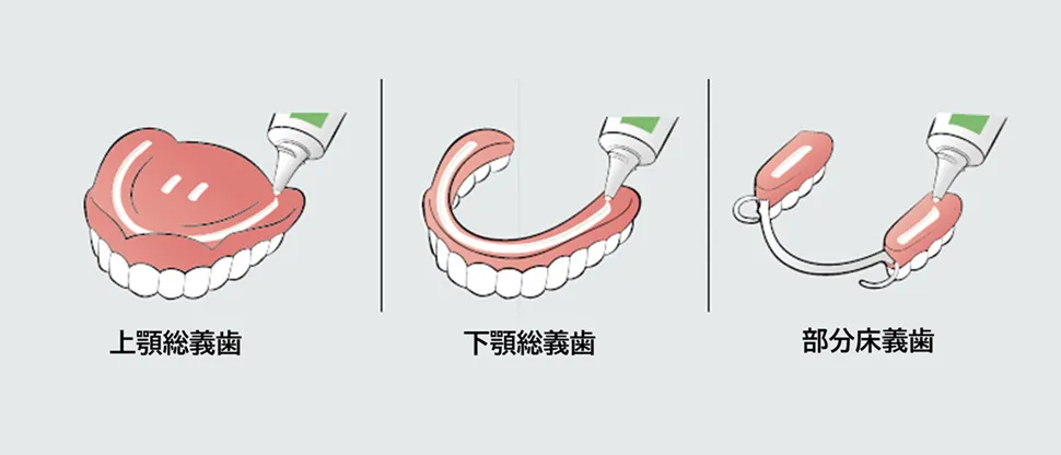極細ノズルと塗布の仕方