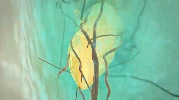 질산칼륨 포뮬레이션