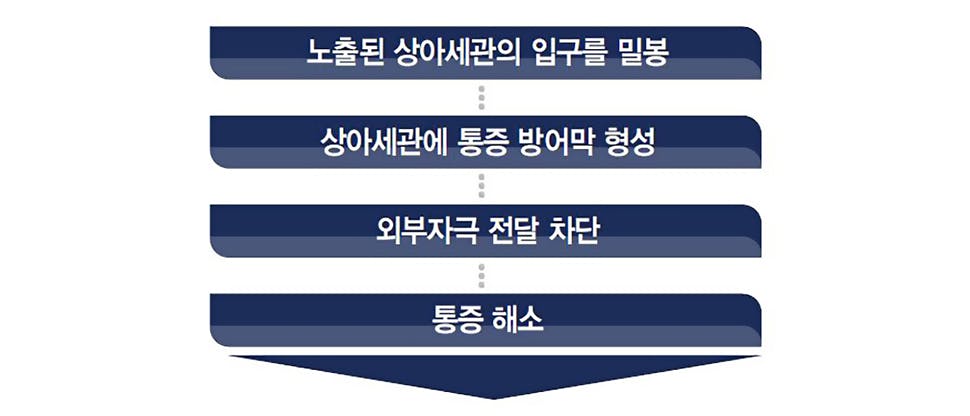 작용기전