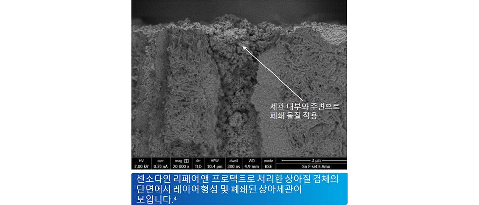 센소다인 리페어 & 프로텍트로 처리한 상아질 검체의 단면