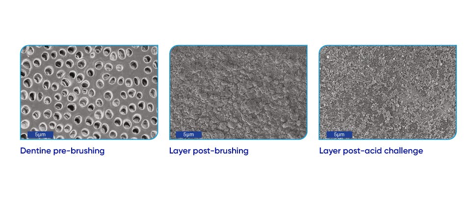 Scanning electron microscope (SEM) images of dentine surface