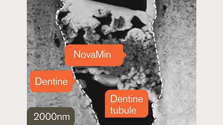 TEM-beeld van dentine bij 2000nm