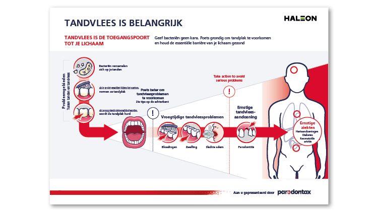 Een infographic van Haleon en Parodontax met de titel 'Tandvlees is belangrijk'. De afbeelding legt uit hoe tandvlees fungeert als toegangspoort tot het lichaam en hoe bacteriën via ontstoken tandvlees kunnen verspreiden. Het toont symptomen van beginnende tandvleesproblemen zoals bloedend tandvlees, zwelling en slechte adem, en waarschuwt voor mogelijke gevolgen zoals hart- en vaatziekten, diabetes en reuma. De boodschap benadrukt het belang van goede mondhygiëne