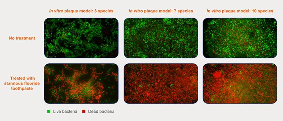 In vitro plaatmodel