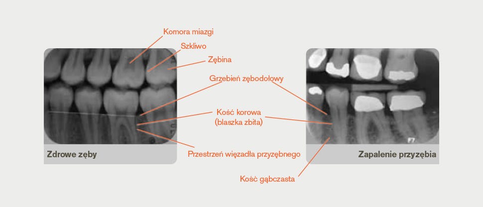 Opisany radiogram